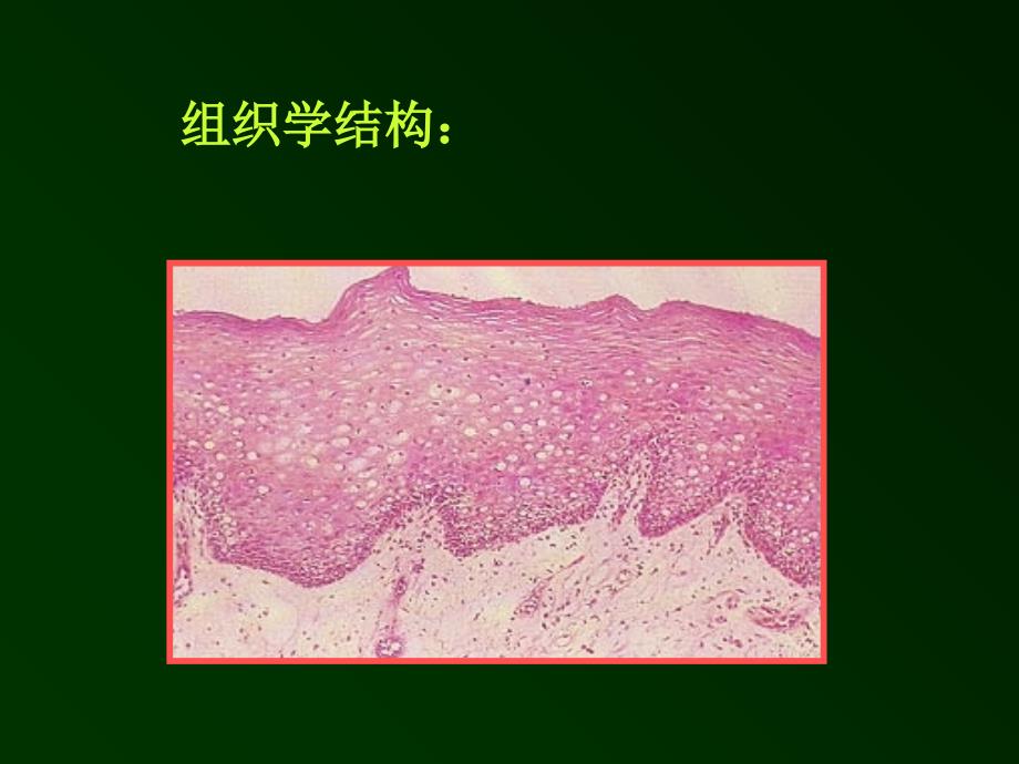 口腔溃疡诊断鉴别_第3页