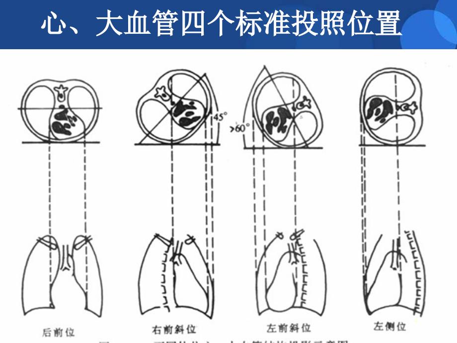 医学PPT课件心与大血管系统影像诊断学_第4页