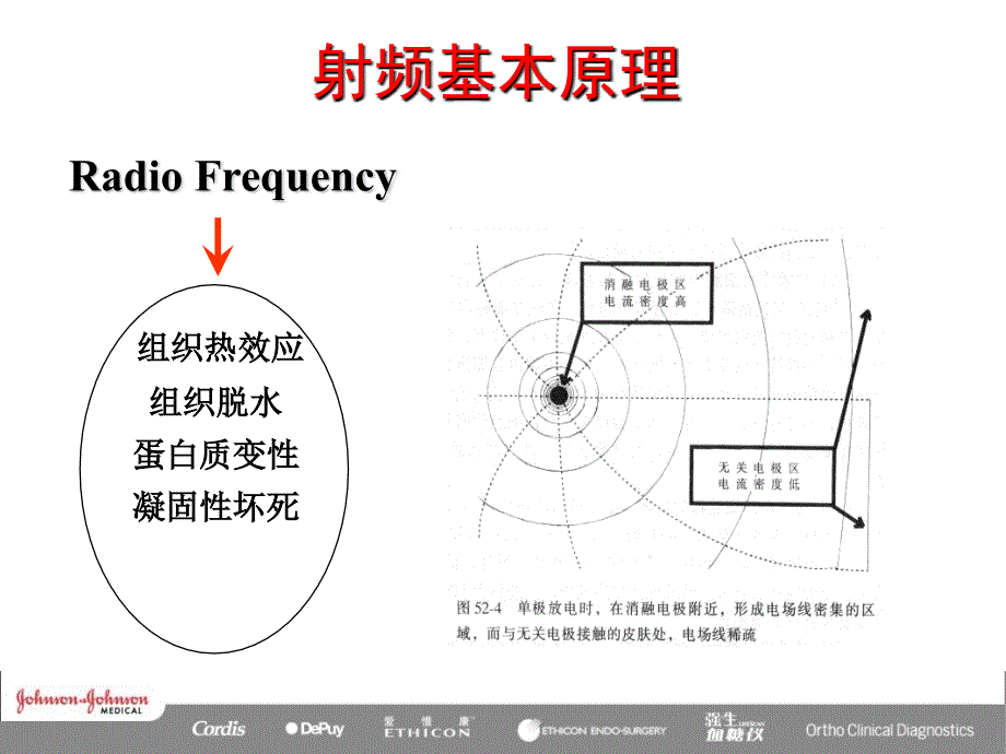 射频消融原理_第4页