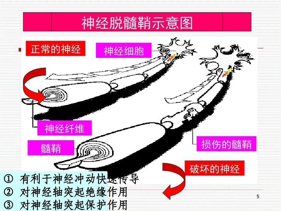 脱髓鞘假瘤mri诊断ppt课件_第5页