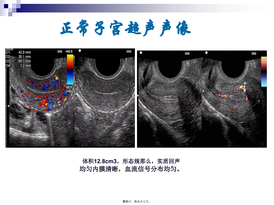 2022医学课件妇科超声常规检查风险评估-(NXPowerLite)_第4页