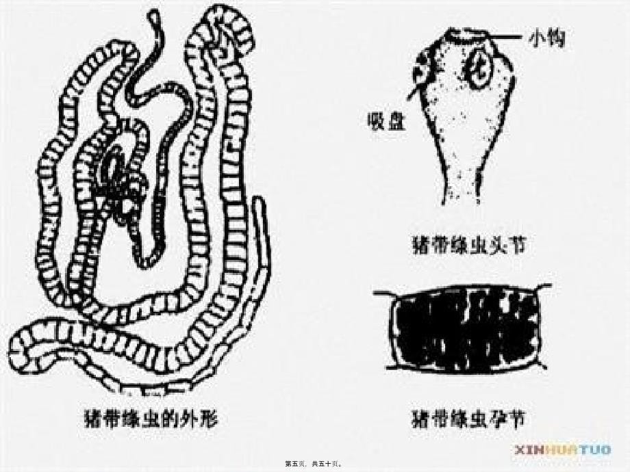 2022医学课件人畜共患寄生虫病的检疫_第5页