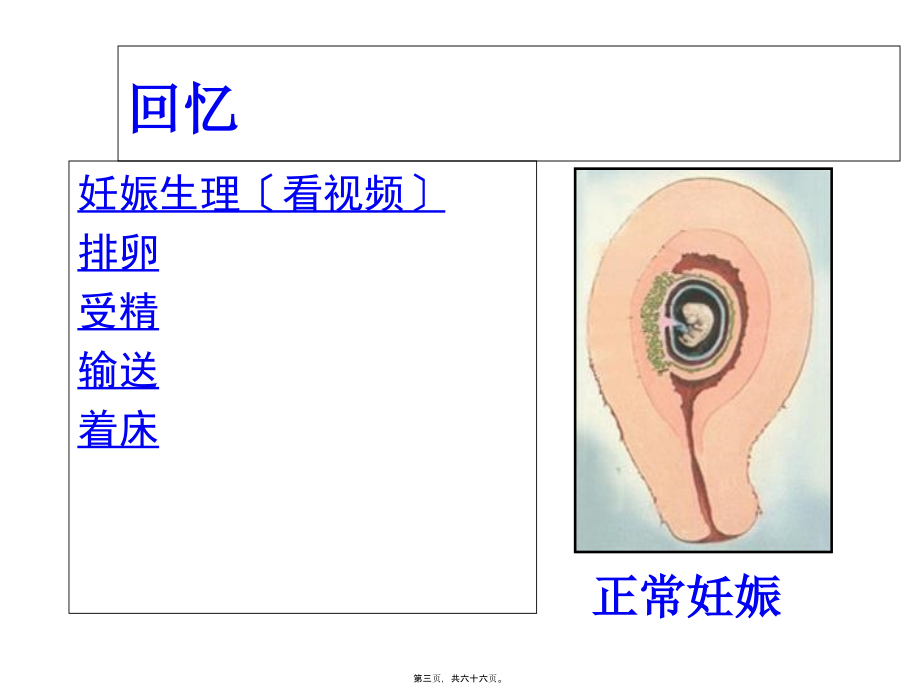 2022医学课件妊娠病异位妊娠_第3页