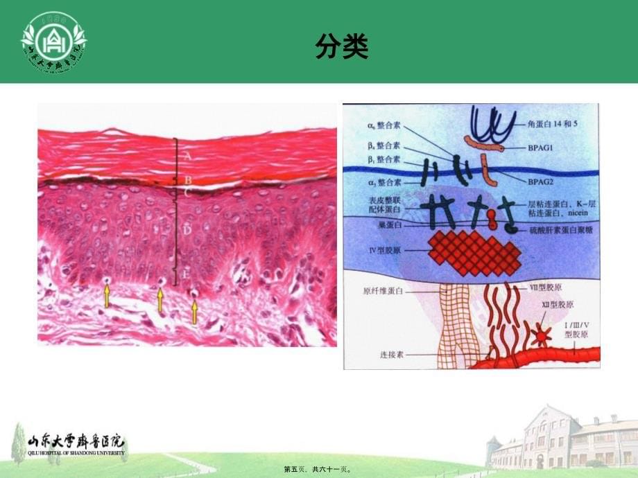 2022医学课件大疱性皮肤病1_第5页