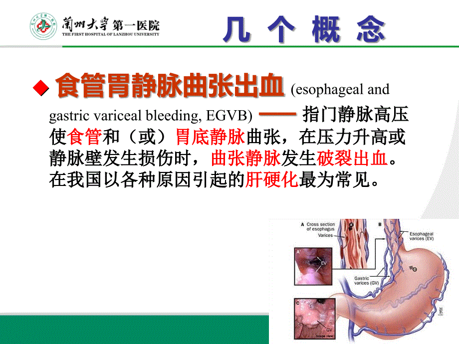 食管胃静脉曲张出血的诊治.ppt_第4页