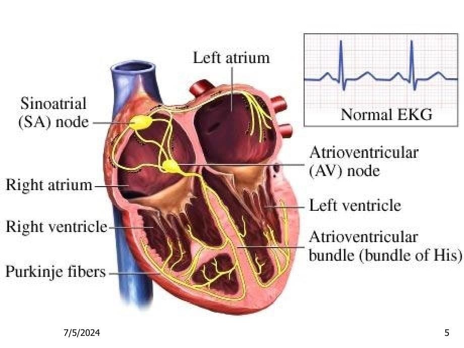 心律失常资料课件_第5页