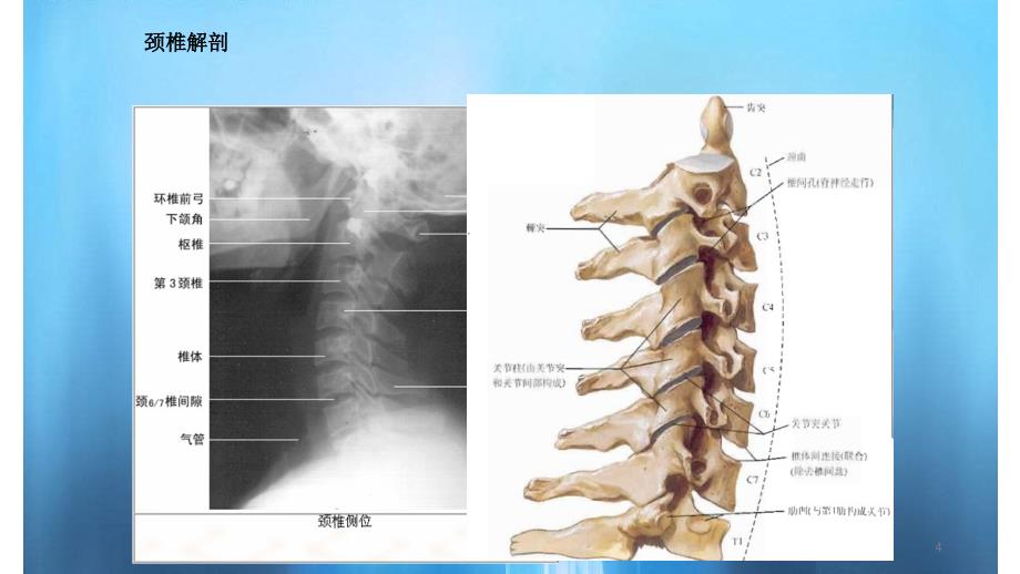 颈椎病的防治科普简单易懂_第4页