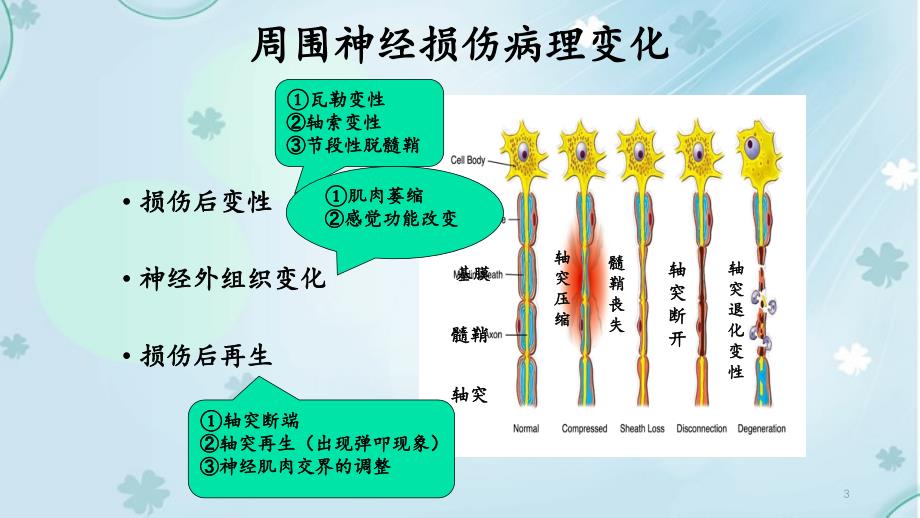 周围神经病损的康复_第3页