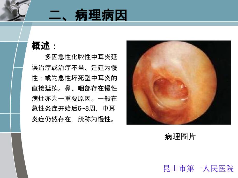 慢性化脓性中耳炎_第3页