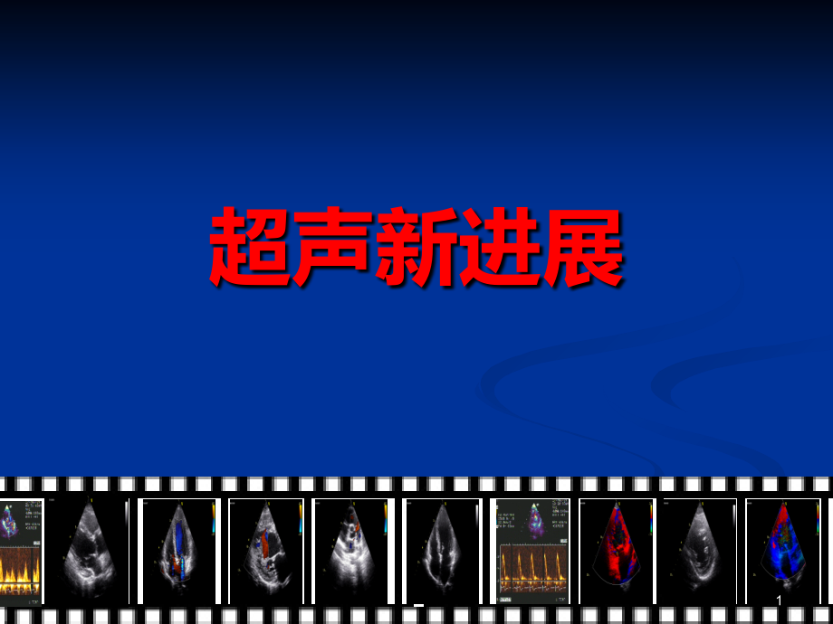 超声新进展课件_第1页