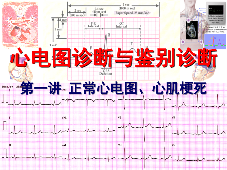 心电图诊断与鉴别诊断正常心电图、心肌梗死_第1页