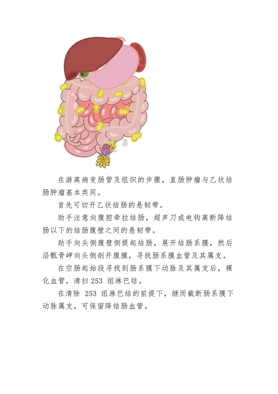 腹腔镜下直肠癌手术图谱_第5页