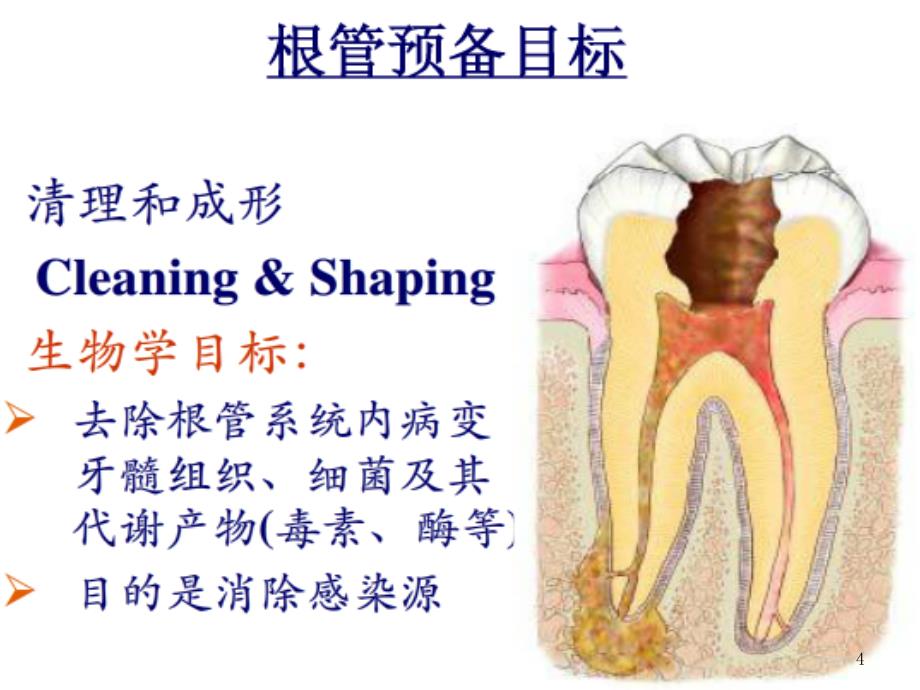 根管预备器械及方法总结ppt课件_第4页