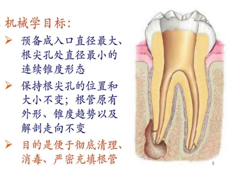 根管预备器械及方法总结ppt课件_第5页