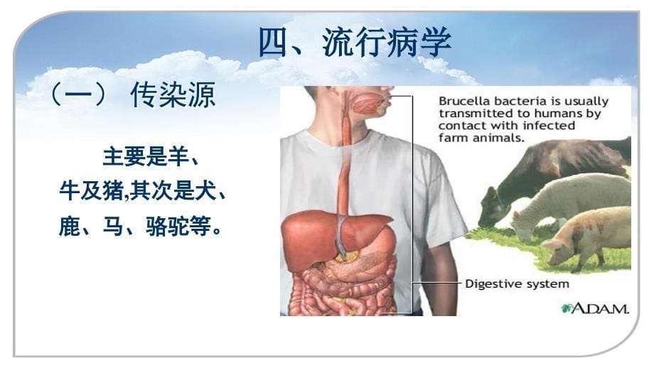 布氏杆菌护理查房_第5页