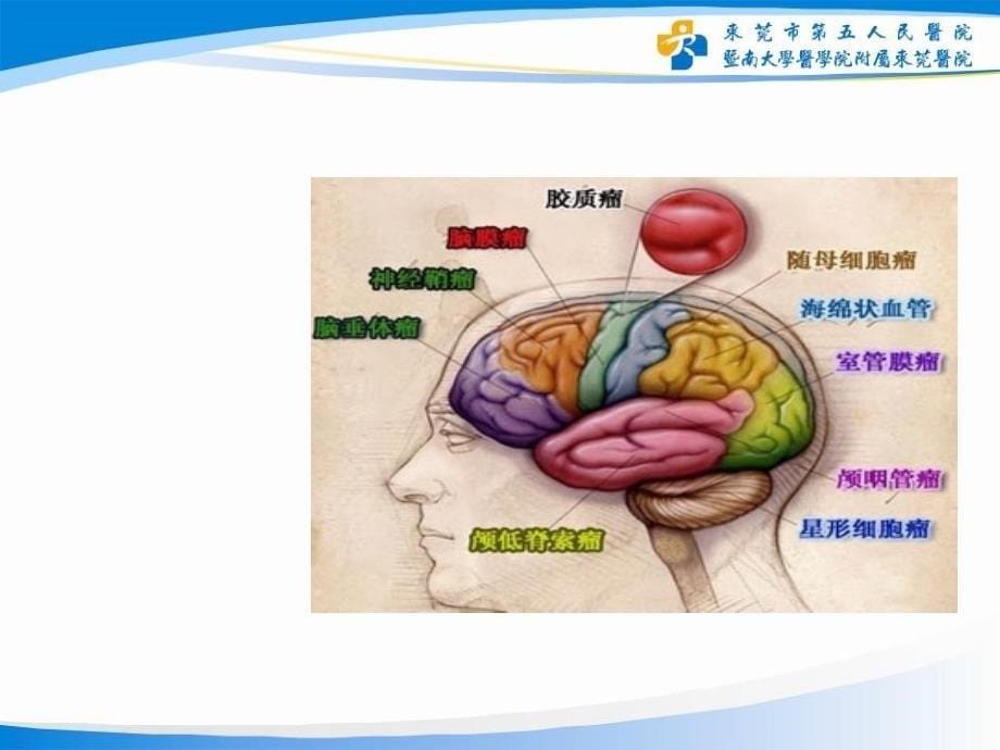 脑肿瘤病人的护理.ppt_第5页