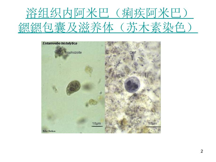 最全常见寄生虫图谱_第2页