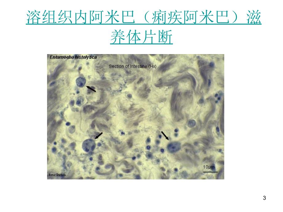 最全常见寄生虫图谱_第3页