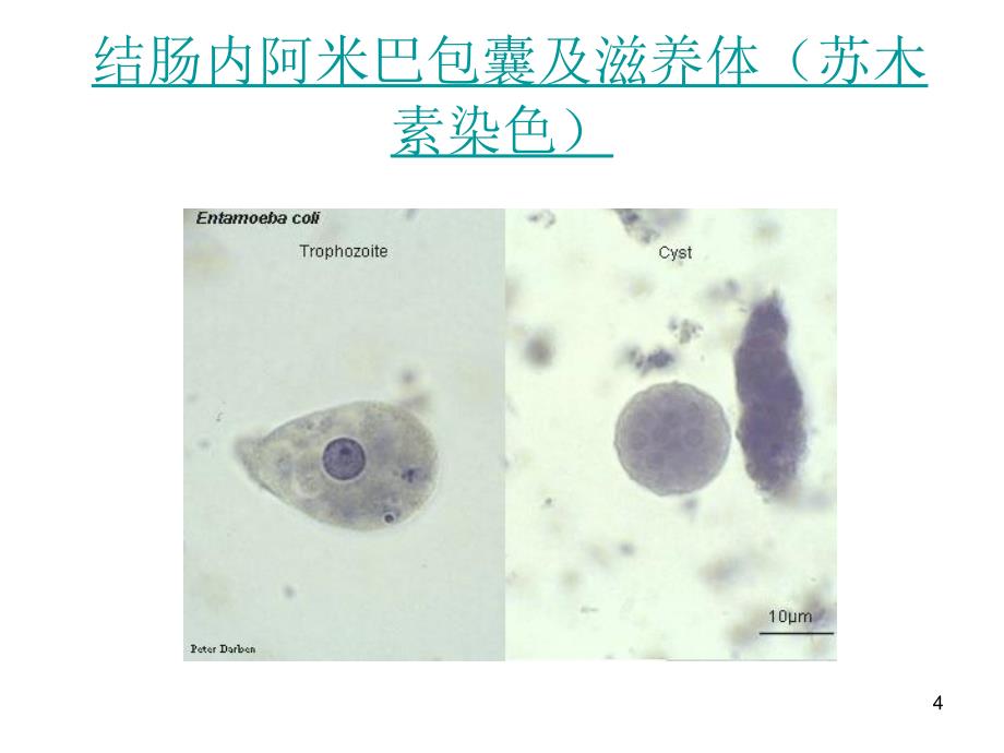 最全常见寄生虫图谱_第4页