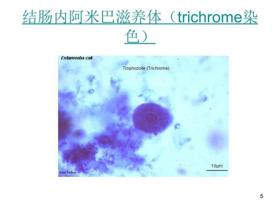 最全常见寄生虫图谱_第5页