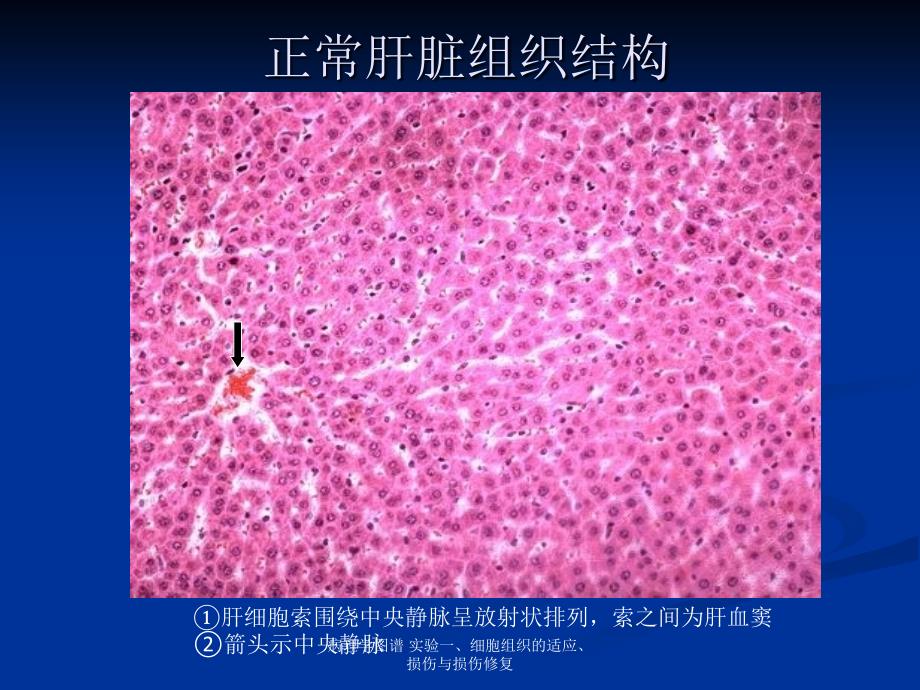 病理学图谱实验一细胞组织的适应损伤与损伤修复_第4页