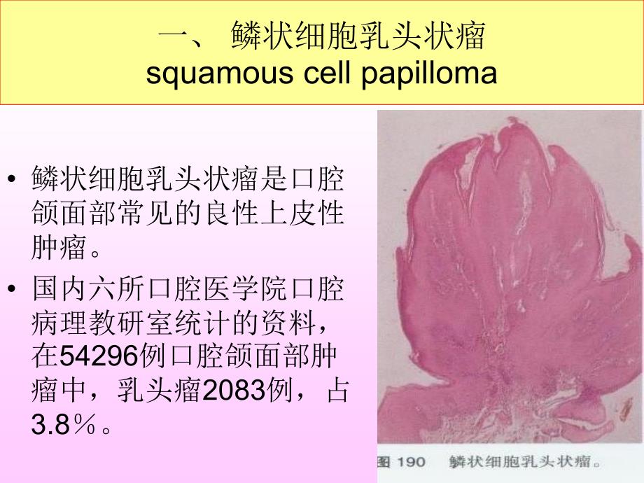 口腔颌面部其他组织来源的肿瘤_第2页