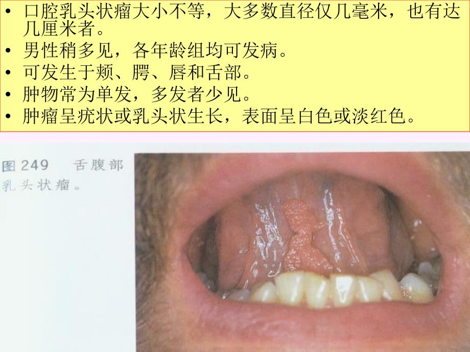 口腔颌面部其他组织来源的肿瘤_第3页