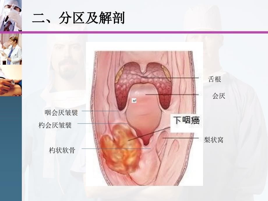 150903下咽癌基本知识_第5页