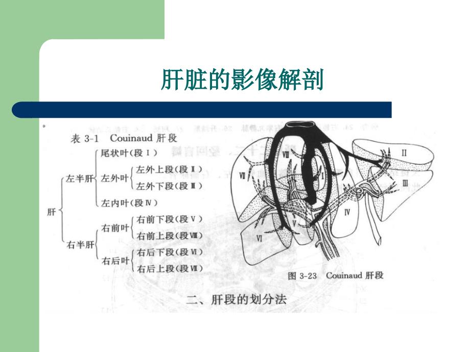 肝细胞癌hcc的影像诊断_第4页