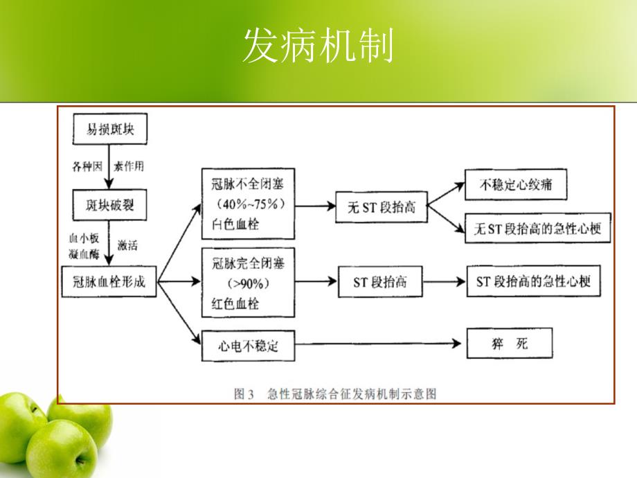 急性冠脉综合征护理(同名435)课件_第4页