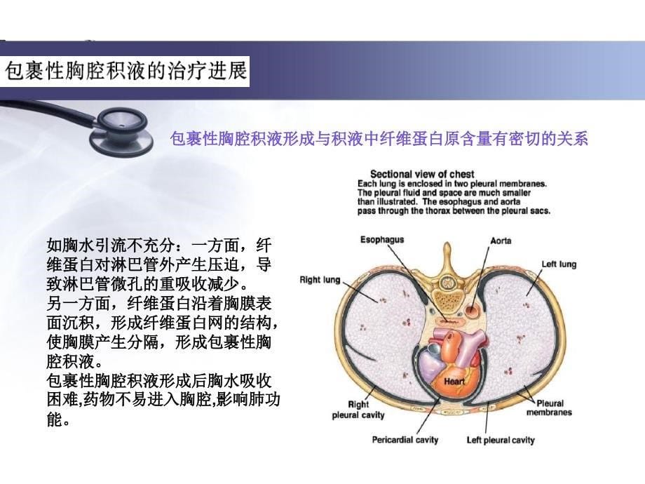 包裹性胸腔积液的治疗进展_第5页