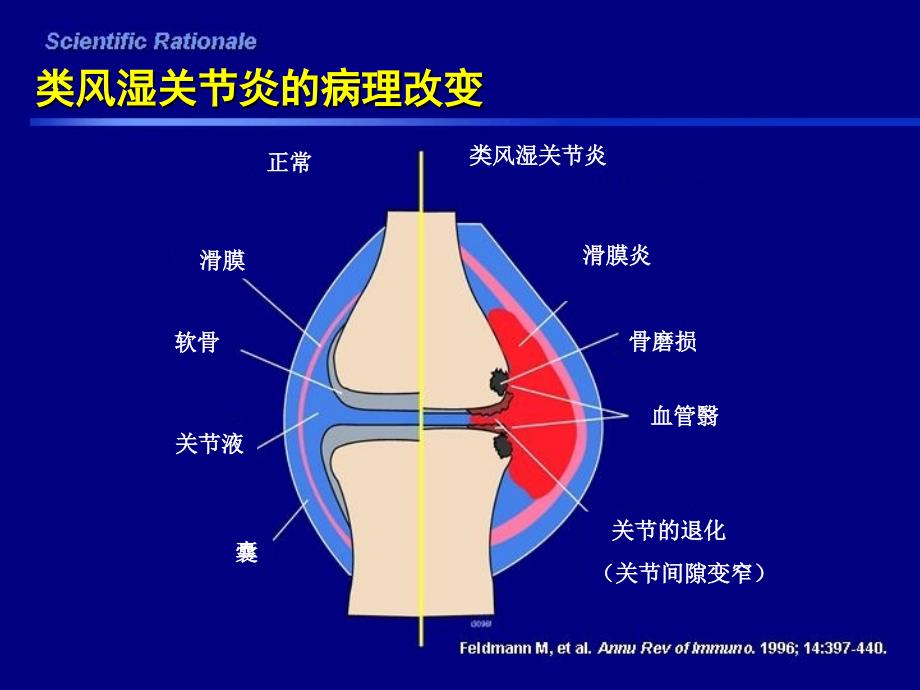 英夫利西对抑制RA骨破坏的作用加入Swefot研究内容_第2页