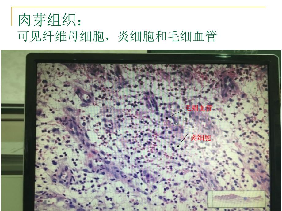 病理学实验切片考试图片.ppt_第3页