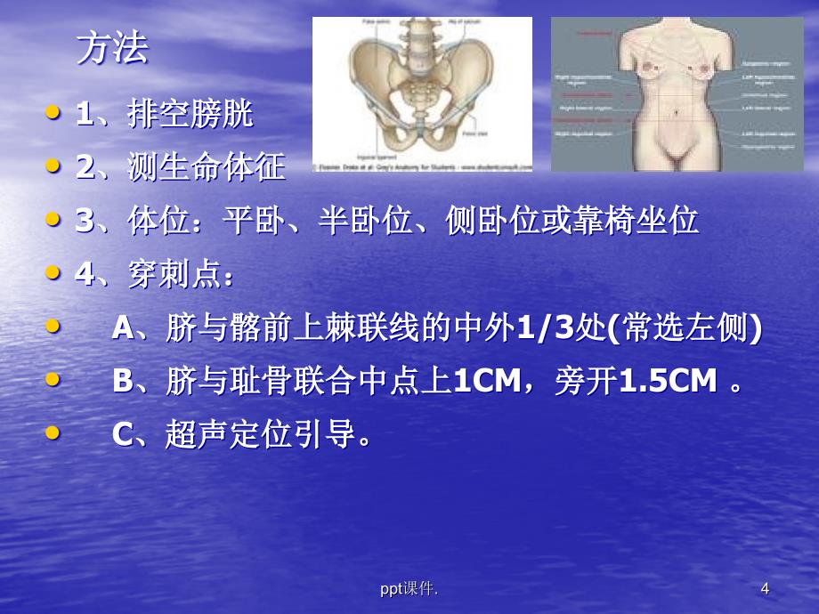 内科四大穿刺术ppt课件_第4页