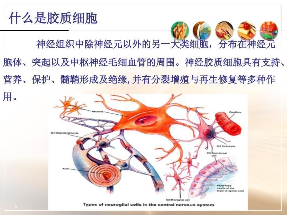 中枢神经系统肿瘤ppt课件_第5页