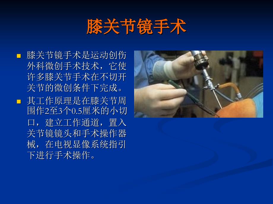 半月板移植术后护理.ppt_第4页