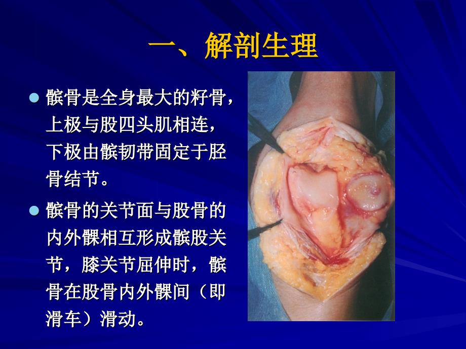 髌骨软化症的诊断及治疗_第3页