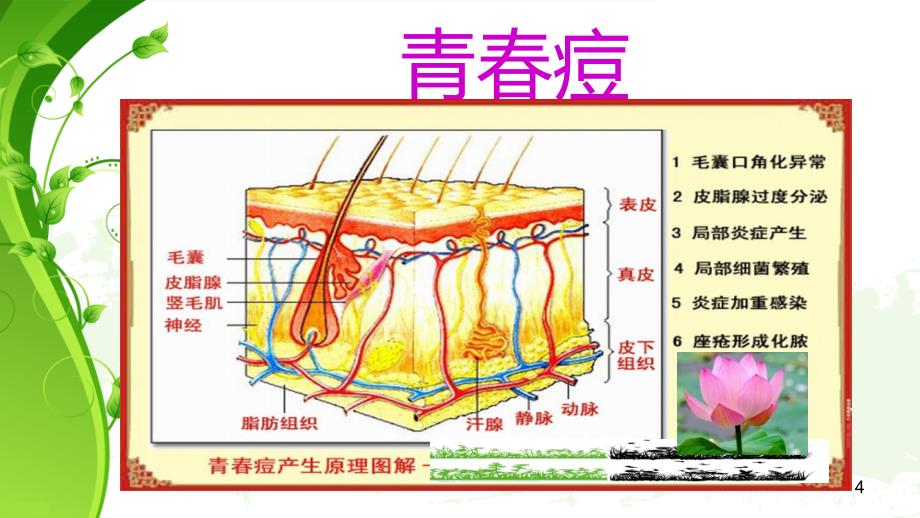 青春痘PPT课件.ppt_第4页