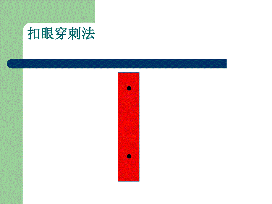 动静脉内瘘穿刺术---扣眼穿刺课件_第3页