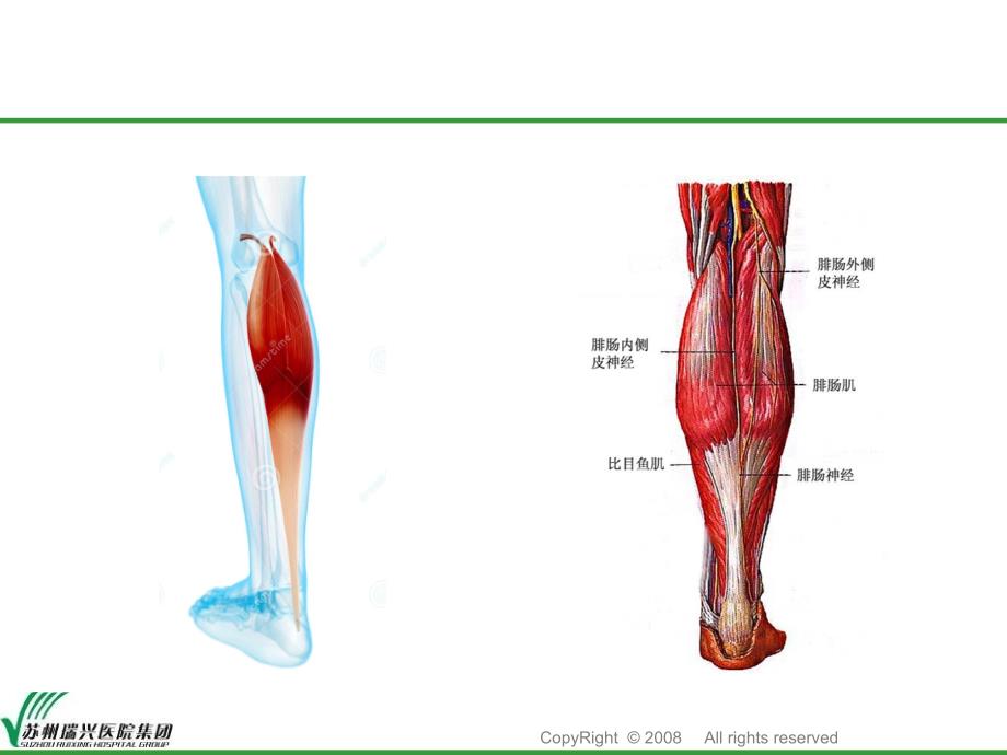 腓肠肌肌皮瓣ppt课件_第4页