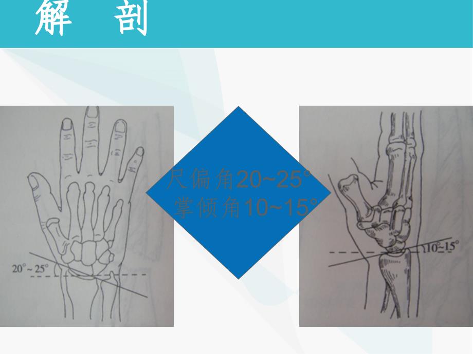 桡骨远端骨折的护理查房_第4页