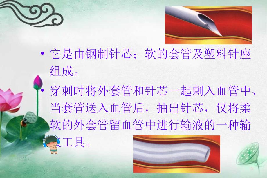 静脉留置针的穿刺技术及护理ppt课件_第4页