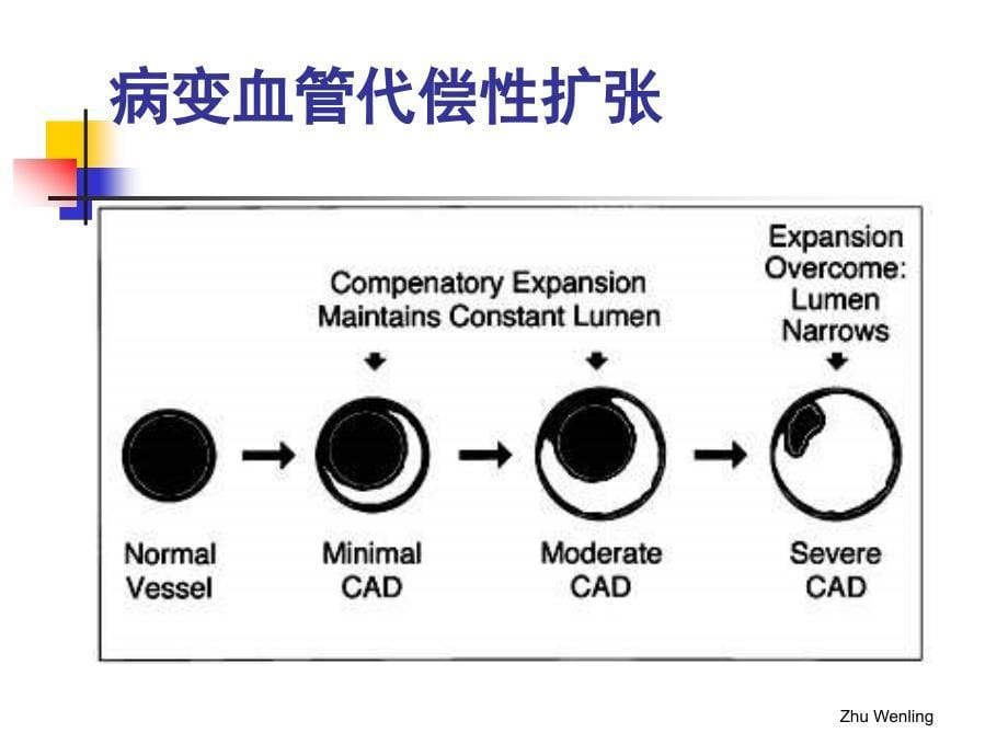 冠心病影像学诊断比较_第5页