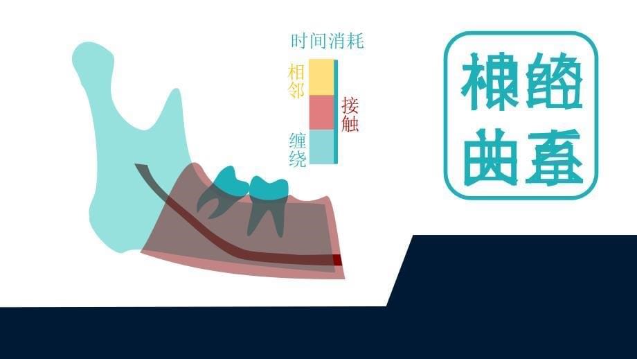 阻生牙拔除难度分析与设课件_第5页