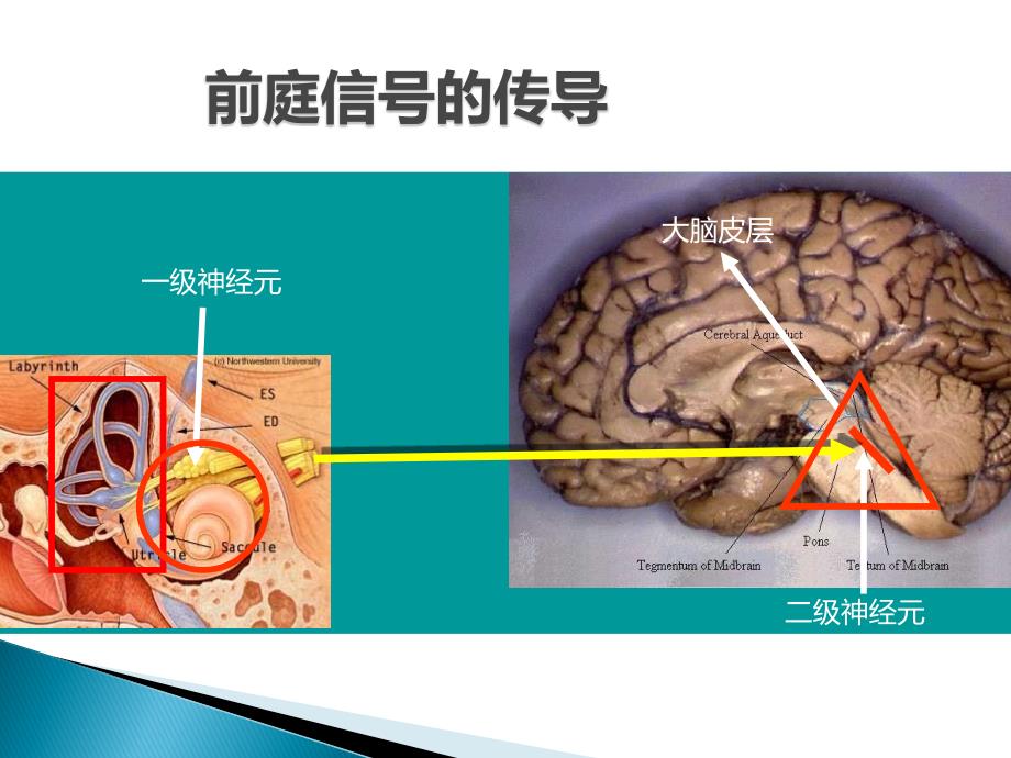 倍他司汀与前庭代偿ppt课件_第4页