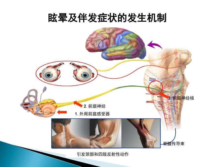 倍他司汀与前庭代偿ppt课件_第5页