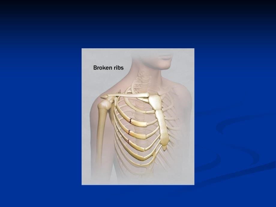 肋骨间隙的定位_第5页