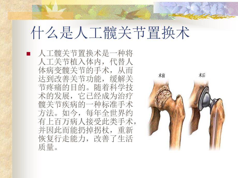 人工髋关节置换健康教育手册._第4页