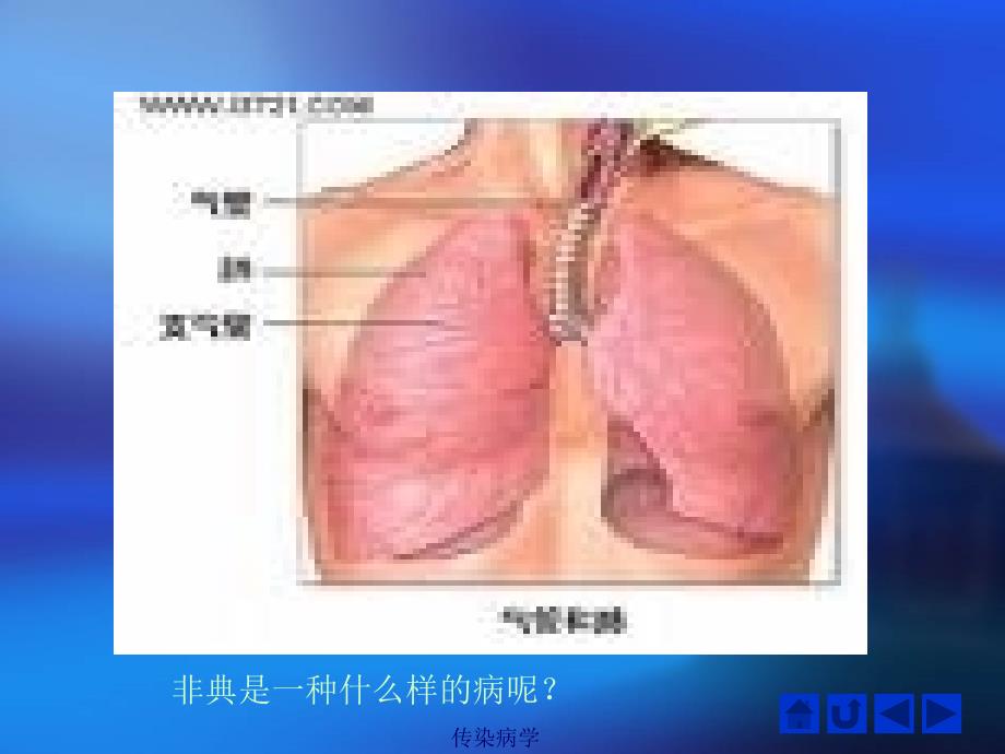 第七课时SARS手足口病腮腺炎_第4页