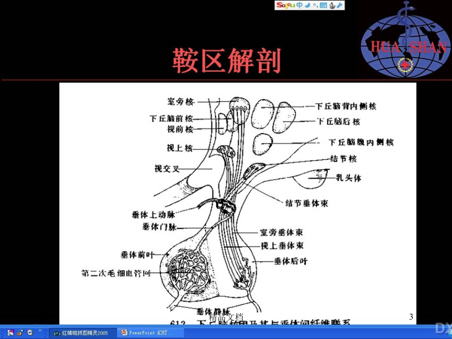 鞍区病变影像诊断课件_第3页